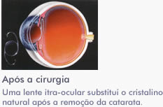 infografia02