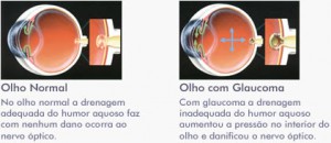 infografia03
